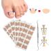 9Pcs Ingrown Toenail Corrector Strips Ingrown Toenail Treatment Strips Brace Foot Care Tool Kit Paronychia Toe Nail Fixer Pedicure Tool Nail Toenail Corrector Sticker Nail - Buy Online on GoSupps.com