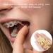 Buy 300PCs Dental Orthodontic Latex Elastics | Elastic Braces Gum & Toothed Gum Pull Tapes | High-Quality Rubber Bands for Orthodontics - Buy Online on GoSupps.com