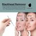 Glamified Blackhead Remover Professional Skincare Spot Treatment Blackhead Remover Tool for Blemish Comedone Whiteheads Pimple Popper with Double Sided Soft Touch and Anti-Slip Design - Buy Online on GoSupps.com