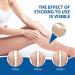 Veinhealth Blue Light Therapy Set for Varicose Veins - Effective Treatment Cream for Legs - Buy Online on GoSupps.com