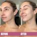 LAPCOS V-Line Contour Face Mask (5pk) | Lift & Tighten Skin | Define Jawline | Hydrating Vegan Collagen | Korean Beauty Must-Have - Buy Online on GoSupps.com