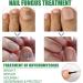 Fungal Nail Treatment For Toenails - Extra Strong Nail Fungus Treatment For Anti Fungal Nail Treatment - Fungal Nail Polish For Fix & Renew Damaged Broken Nails - Buy Online on GoSupps.com
