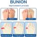 Orthoes Bunion Relief Socks - Projoint Antibunion Health Socks for Toe Alignment and Compression - Buy Online on GoSupps.com