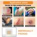 Carbou Silicone Foam Dressing 4x4 with Gentle Border - Waterproof, High Absorbency Wound Care Bandage for Pressure Sore, Leg Ulcer, Diabetic Ulcer - 10 Pack - Buy Online on GoSupps.com
