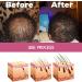 Les Huiles De Batana Pour La Croissance Des Cheveux REGROWTH Traitements Repousse Renforcent Le Cuir Chevelu Am liorer Circulations Sanguines Du Beurre D'huile Batana Pour La Croissance - Buy Online on GoSupps.com