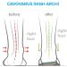 FootScientific High Arch Orthotic Insoles Men's 7-7.5/Women's 9-9.5 - Size M7-7.5/W9-9.5 - Buy Online on GoSupps.com