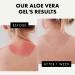 Organic Pure Aloe Vera Gel for Face, Hair & Body - Australian Hand Harvested & Cold Pressed - Soothing & Hydrating After Sun Skin Care - Buy Online on GoSupps.com