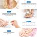 Fungal Nail Treatment - Fungal Nail Treatment for Toenails Extra Strong - Anti Fungus Nail Repair and Strengthen - Toenail Fungus Treatment for Thickening Yellow-Brown Discoloration Ragginess 20ML - Buy Online on GoSupps.com