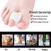 Gel Toe Separators for Overlapping Toes - 4 PCS Bunion Big Toe Straighteners - Toe Corrector Fixator for Hallux Valgus - Relieve Pain - Size Large - Buy Online on GoSupps.com