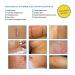 Aroamas Silicone Scar Removal Sheets 4 pcs White Professional, Drug-Free Solution for Burn, Keloid, Acne, Surgery Scars Soft Adhesive Fabric Strips, 2 Month Supply - Buy Online on GoSupps.com