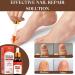 Fungal Nail Treatment for Toenails - Extra Strong 30ml Formula - Safely Reclaim Healthy Nails - Buy Online on GoSupps.com