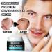 Mens Anti Aging Face Cream Mens Face Cream Mens Moisturiser Face Mens Anti Wrinkle Face Cream Mens Anti Aging Moisturiser Skin Tightening Men's Moisturiser Reduce Fine Lines Firming Men Skincare - Buy Online on GoSupps.com