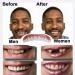 Batlam Temporary Dentures | Cosmetic Veneer Teeth for Men & Women | Silicone Dental Prosthesis for Whitening - Buy Online on GoSupps.com