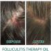 FIOERDTUIE Adults Hair Growth Essential Oil Follicle Repair Moisturizing Nourishing Essence Haircare Serum Beauty Supplies - Buy Online on GoSupps.com