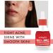 Vitayes AHA 10% + BHA 2% Red Exfoliating Serum Pore Refining Revitalising Natural Ingredients for All Skin Types 30 ml - Buy Online on GoSupps.com