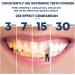 Baking Soda Teeth Whitening Powder Brighten Smile, Remove Yellow Stains, Freshen Breath - Buy Online on GoSupps.com