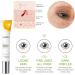 Vitamin C Eye Cream for Dark Circles and Puffy Eyes Brighten Instant Tightener Under Eye Repair Cream Hydrating Brightening Anti Aging Eye Bags Remover Wrinkle Filler Eye Serum for All Skin Types - Buy Online on GoSupps.com