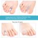 Toe Spreaders for Overlapping & Crooked Toes - 12 Piece Correction Cushion Set (Large) for Hallux Valgus & Hammer Toes - International Shipping Available - Buy Online on GoSupps.com