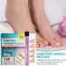 Ingrown Toenail Patch Ingrown Toenail Corrector | Toenail Repair to Relieve Nail Groove Nail Correction Patches Suitable for Men Women and Elderly Adern - Buy Online on GoSupps.com