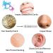 Visual Ear Camera Portable Wireless WiFi Otoscope with Fast Charging Widely Compatible for Daily Inspection Mouth Gums Nasal Cavity Scalp Hair Roots Pink - Buy Online on GoSupps.com