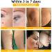Turonu New Zealand Bee Venom Cream for Skin Bee Venom Repair Cream Suitable for men and women of all skin types - 60 Ml (1pcs) 1pcs 60 ml (Pack of 1) - Buy Online on GoSupps.com