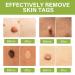 SCOBUTY Skin Tag Removal Kit Verruca Treatment Wart and Mole Remover for Hands Face - Buy Online on GoSupps.com