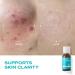 BLANC NATURE Magic Tea Tree Oil Spot Care for Face Clarifying Facial Oil for Oily and Sensitive Skin Lightweight and Fast Absorption Vegan Korean Skincare 0.68 fl oz (20ml) - Buy Online on GoSupps.com