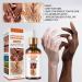  FADELU 2 x Acanthosis Nigricans Therapy Oil Dark Spot Corrector Oil Dark Knuckle Whitening Serum Dark Spot Remover Lighten Body Black Skin for Brighter Firmer Skin - Buy Online on GoSupps.com
