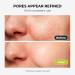 RoowLtne 2% Salicylic Acid Serum for Face: Acne & Blackhead Remover, Pore Reducer for Oily & Acne Prone Skin, Gently Exfoliating Facial Serum with Witch Hazel, 1.01 Fl Oz - Buy Online on GoSupps.com