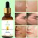 Vitamin C Face Serum | Anti-Aging & Brightening Serum with Hyaluronic Acid & Vitamin E | Dark Spot Remover for Even Skin Tone - Buy Online on GoSupps.com