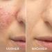 carvenchy vitamin C Facial Serum Essence Hydration Skin Moisturized Brightens Skin Tone Moisturizes and Hydrates 1pc - Buy Online on GoSupps.com