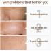Glutathione Face Cream - Even Skin Tone Face Cream - Kojic Acid Face Cream - Sensitive Moisturising Cream - Face Moisturiser Cream - Anti Wrinkle Anti Aging Skin Tone Correcting (50g) - Buy Online on GoSupps.com