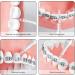 Interdental Brushes Extra Soft Wei Size 2 - Pack of 16 for Gentle Cleaning | Enhance Oral Care with Our Premium Interdental Brushes - Buy Online on GoSupps.com
