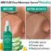 BREYLEE Masque anti-points noirs & s rum minimiseur de pores bandes de nez l'huile d'arbre th + 100 papiers raffermissement de contr le de l'huile peau resserr e et raffermissante Kit de nettoyage des pores nasaux - Buy Online on GoSupps.com