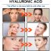 Hyaluronic Acid Microneedling Serum - Hyaluronic Acid Face Serum - Gla-Mory Micro-Infusion Facial System - Hyaluronic Acid Serum for Face - Dark Spot Remover for Face - Face Serum for Women - Buy Online on GoSupps.com