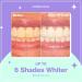 Smileactives Teeth Whitening Pen - Fast Stain Remover Dental Quality Gel Vanilla Mint Flavor Travel-Friendly 3 Pack - Whiten Your Smile Instantly - Buy Online on GoSupps.com
