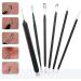 Professional Blackhead Remover & Pimple Popper Tool Kit - 6 Piece Stainless Steel Extractor Set for Comedone Removal - Buy Online on GoSupps.com