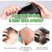 Castor Oil for Hair - Castor Oil Cold Pressed | Natural Hair Growth Oil with Castor | Strengthening Nourishing Hair Regrowth Oil | Hair Thickening Oil 30ml Promotes Longer Thicker Hair - Buy Online on GoSupps.com
