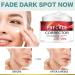 Anti Freckle Face Cream - Skin Lig_htening Cream - Vitamin C Cream for Dark Spot Remove - Hydrating Face Cream for Dry Skin - Face Moisturizer for Women - Even Skin Tone Anti Aging - 30g - Buy Online on GoSupps.com