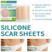 Teksome Scar Tape for Body - 1.5m Stretch Mark Remover Strips | Silicone Gel Tape for Scars & Stretch Marks - Buy Online on GoSupps.com