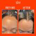 Lace Melting Spray Ashy Lace Melting Spray for Lace Wigs Lace Bond Spray Extra Hold Lace Melting Spray Adhesive Wig No Residue Long Lasting Safe Formula - 4.2 oz - Buy Online on GoSupps.com