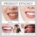 Fresh Mint Toothpaste Cleans Tooth Surfaces Reduces Plaque Buildup Keeps Teeth Bright and White Delivers A Refreshing Mint Flavor(1pcs) - Buy Online on GoSupps.com