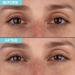 Hyaluronic Eye Patches Anti Dark Circle and Puffy Eyes Dr. Nature - Hyaluronic Acid & Caffeine Eye Cream + Reusable Under Eye Mask - 2 Eye Patches 100% medical-grade silicone - Buy Online on GoSupps.com