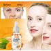  Frovetani 2 Pack Turmeric Serum for Dark Spot Removal Dark Spot Correction Oil Face and Body Serum Oil Natural Turmeric Oil for Fights Acne Skin - Buy Online on GoSupps.com