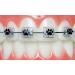 Braces Wax Alternative Bracket Cover Bumper Orthodontic Braces Accessories Snapcaps Paw Print 10 Ct.