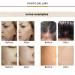 Koi Beauty 192 Derma Roller - Titanium Microneedle for Face, Body, Scalp & Beard Growth | 0.5mm Microneedling Tool - Buy Online on GoSupps.com