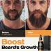 Waking Forest Beard Oil - Sandalwood Beard Growth Oil with Vitamin E Rosemary Castor & Argan - Ideal for Men's Grooming - Buy Online on GoSupps.com
