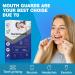 Mouth Protection for Teeth Grinding - 4 Anti-Snoring Rails in 2 Sizes | Premium Transparent Bruxism Solution - Buy Online on GoSupps.com