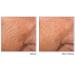 RoC Retinol Correxion Line Smoothing Night Serum Capsules - Anti-Aging Treatment for Fine Lines, Dark Spots, Acne Scars - 10 Count - Buy Online on GoSupps.com