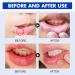 Spray Ulc res de la Bouche Nouveau Spray de Soulagement de la Douleur Dentaire Spray de Soulagement Ulc res Spray Anti-aphtes R paration des Tissus Gingivaux Spray de Soulagement Ulc res Buccaux - Buy Online on GoSupps.com
